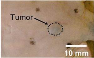 Опухоль кожи (вверху) после обработки новым контрастным агентом, который улучшает видимость раковых клеток (внизу) с помощью инновационного медицинского прибора для визуализации.