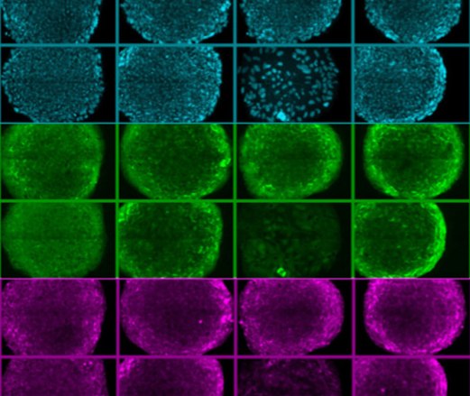 Изображение эмбриональных стволовых клеток  человека, выращенных на синтетической поверхности, разработанной учеными  из MIT. Клетки в верхних рядах (синие) окрашены таким образом, чтобы  были видны их ядра, в то время как окрашивание  в средних и нижних рядах  выявляет обязательно присутствующие в стволовых клетках белки. Зеленые  клетки окрашены для визуализации белка Oct4 (использован зеленый  флуоресцентный белок),  красные – для SSEA-4.