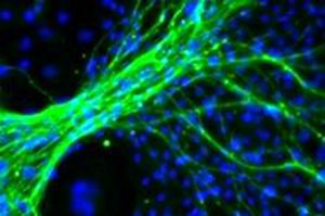 Новая  клетка:  микроскопическое изображение показывает нейроны (зеленые), созданные из  плюрипотентных стволовых клеток с использованием модифицированной  РНК.