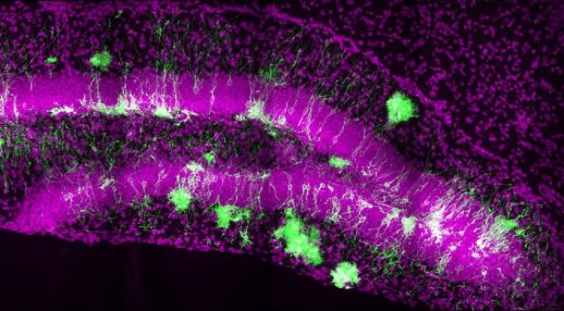 Гиппокамп мыши со взрослыми нервными стволовыми клетками (помечены зеленым)
